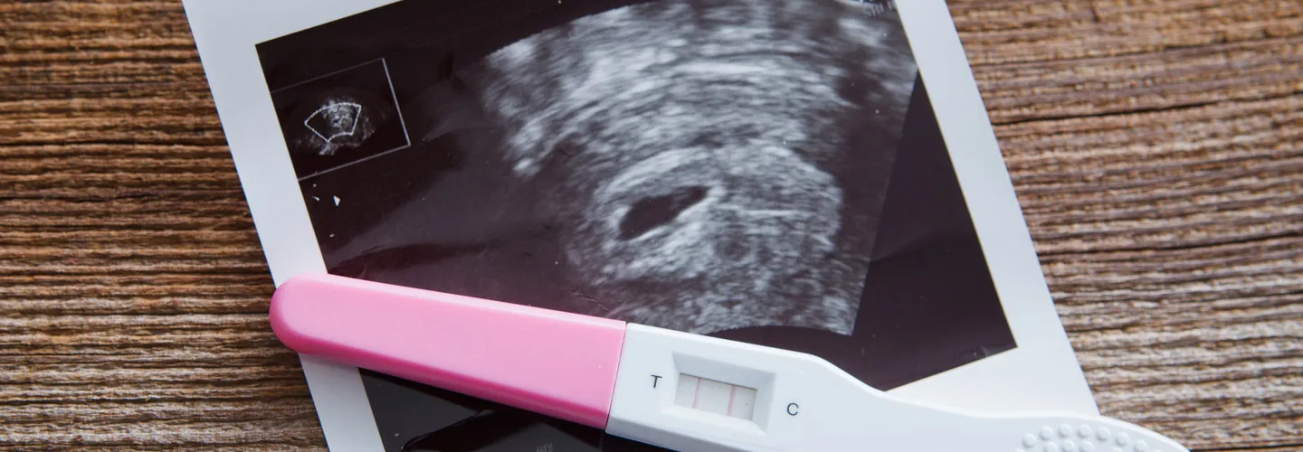 Navigating the Silent Journey of Chemical Pregnancy