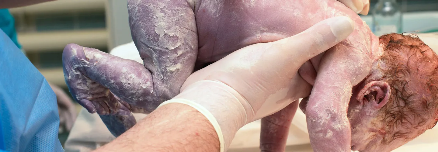 Can IVF Babies Be Delivered Naturally?